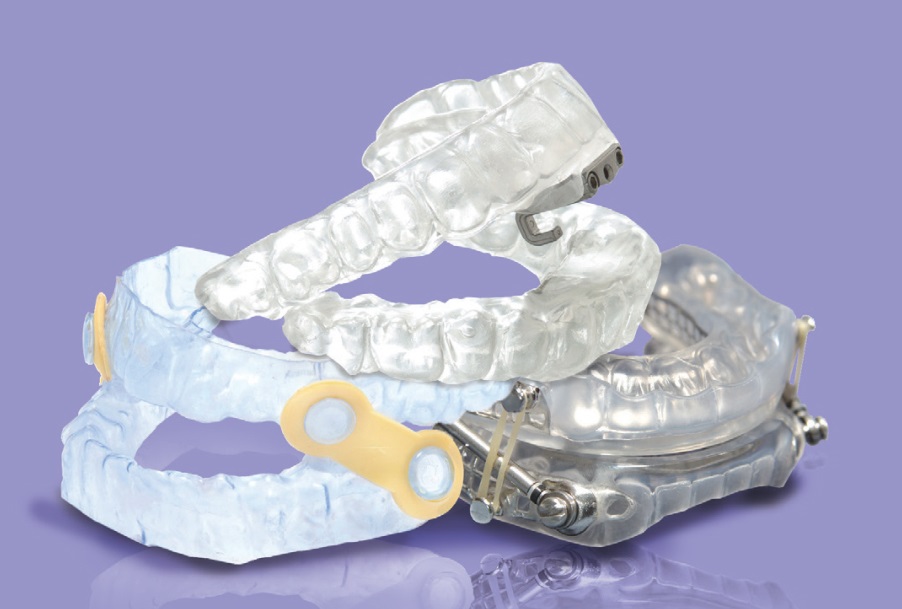 Oral Appliance Therapy For Obstructive Sleep Apnea Sleep Doctors Ft Myers Bonita Springs 2278